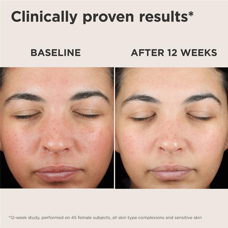 EltaMD UV Skin Recovery SPF 50 Face Sunscreen