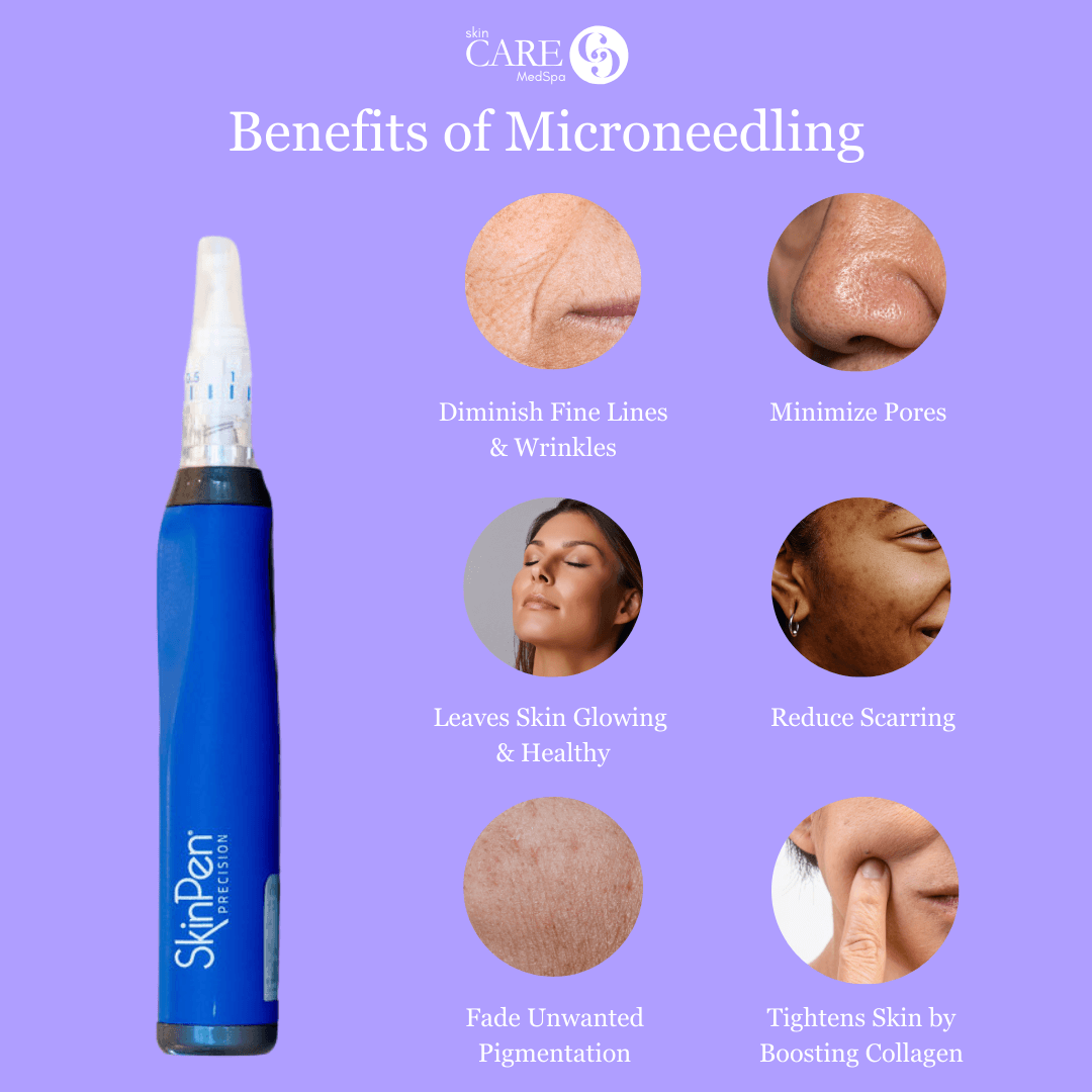 EXCLUSIVE: Package of 3 Microneedling Face Treatments + ZO Accelerating Serums