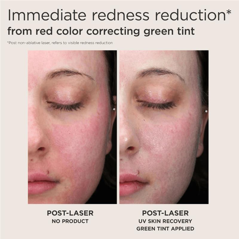 EltaMD UV Skin Recovery Red Color Correcting Green Tint Broad Spectrum SPF 50