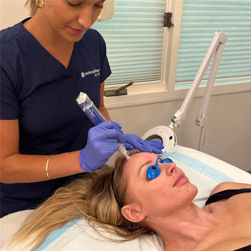 EXCLUSIVE: Package of 3 Microneedling Face Treatments + ZO Accelerating Serums