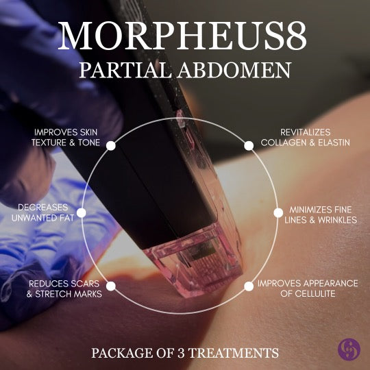 Morpheus8 Partial Abdomen (Package of 3 treatments)