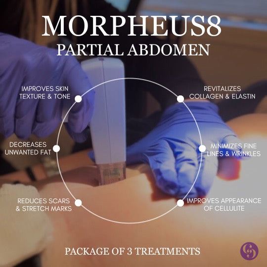 Morpheus8 Partial Abdomen (Package of 3 treatments)