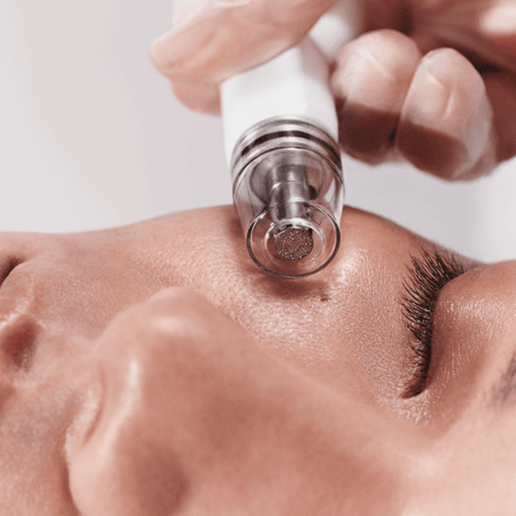 DiamondGlow™ Facial (Express)