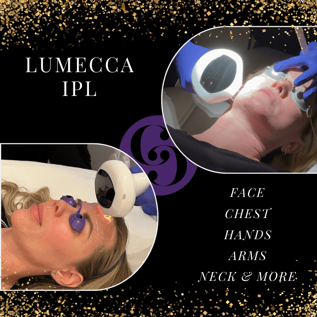 LUMECCA™ Package of 4 treatments