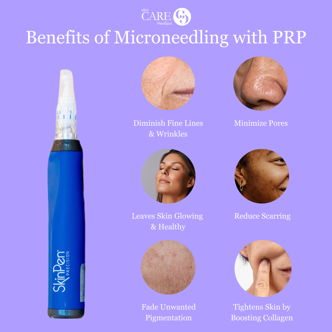 EXCLUSIVE: Package of 3 Microneedling Face Treatments + ZO Accelerating Serums