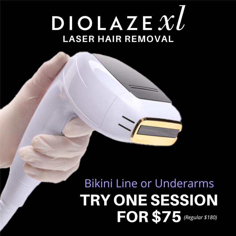 Diolaze Laser Hair Removal – 1 Session (Underarms OR Bikini Line)