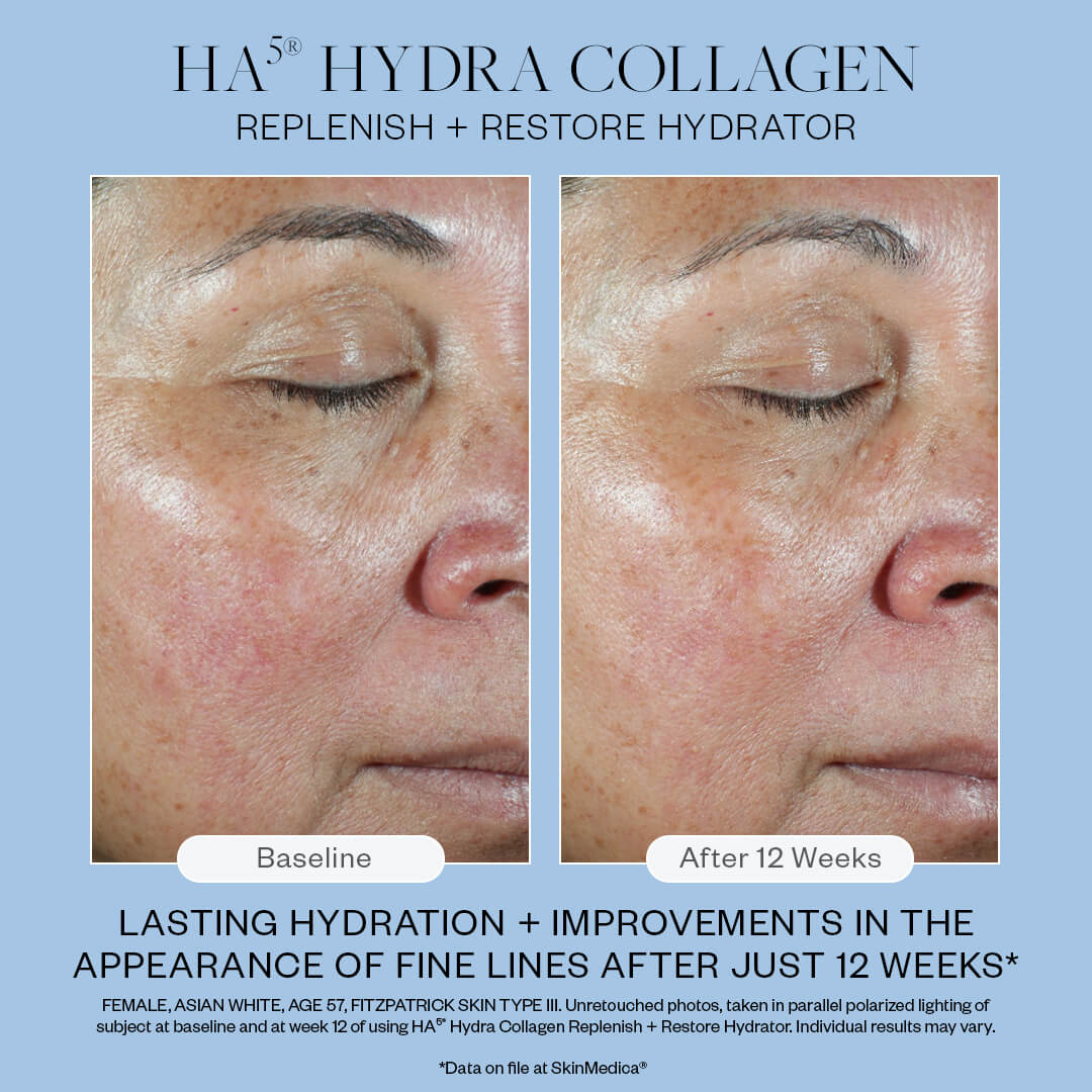 **NEW** SkinMedica® HA5® HYDRA COLLAGEN (2 oz)